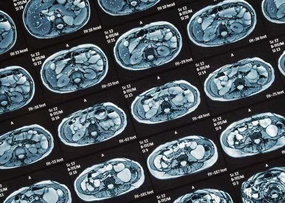 MRT-Untersuchung, Detail, MRT-Scan des Dünndarms, nichtinvasiver medizinischer Test zur Diagnose von Erkrankungen des Darms, wie Morbus Crohn, Großbritannien, Europa Copyright: imageBROKER/SimonxBelcher ibxdig04739480.jpg