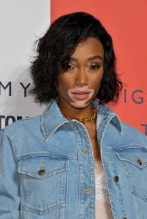 Model Winnie Harlow attends the event Tommy Hilfiger Presents Tokyo Icons in Tokyo, Japan on October 8, 2018.  TKP2018100807 KEIZOxMORI