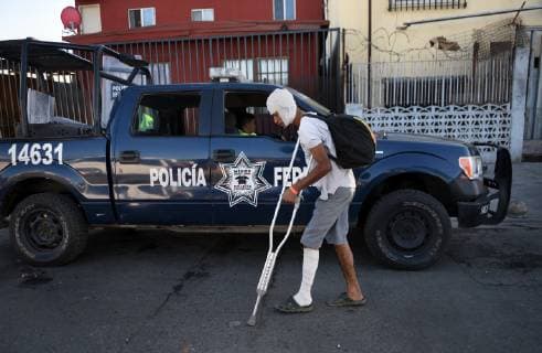 November 26, 2018 - Tijuana, Mexico - HENRY JOSE JUAREZ VILLEGAS 16 years old from El Salvador was injured yesterday during the protest at the border. He said a tear gas canister hit his head. He walks from the camp in search of food. He believes Obama was good but with Trump he thinks he is the owner, but he is only a president, he stated. Yet he still holds onto the hope of living in America. The migrant caravan camp Centro Deportivo Benito Juarez seemed more somber on November 26, 2018the day after chaos and U.S. agents firing tear gas at them when they broke through Mexican police line during a protest march and ran to the U.S. border. Some were caught there yesterday to be deported and there was a rumor in the camp all would be sent back to Honduras today which led some to pack and leave to stay on the streets rather than return. - ZUMAg208 20181126_zap_g208_006 Copyright: xCarolxGuzyx