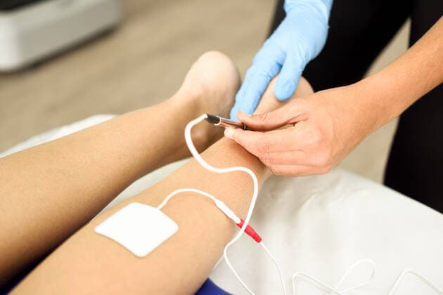 Electroacupuncture dry with needle connecting machine used by acupunturist on female patient for acupuncture guided by EPI Intratissue Percutaneous Electrolisis. Electro stimulation in physical therapy to ankle of a young woman in physiotherapy center.,model released, Symbolfoto,property released ING_18944_04828