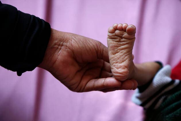 (191210) -- SANAA, Dec. 10, 2019 (Xinhua) -- A woman holds the foot of her malnourished child as he receives medical treatment in Al-Sabeen hospital in Sanaa, Yemen, Dec. 10, 2019. (Photo by Mohammed Mohammed Xinhua) YEMEN-SANAA-CHILDREN 