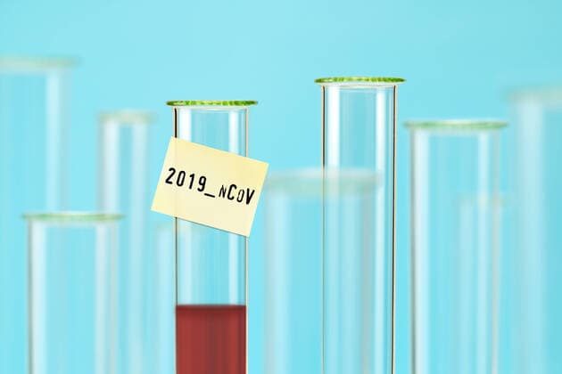 FOTOMONTAGE, Reagenzglas mit Zettel und der Aufschrift 2019-nCoV, Symbolfoto Coronavirus