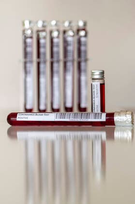 Blutprobe in einem Reagenzglas zur Analyse des Coronavirus und zur Herstellung einen Impstoffs (Attrappe, Dummy)