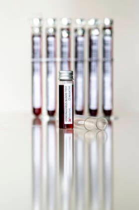 Blutprobe in einem Reagenzglas zur Analyse des Coronavirus und zur Herstellung einen Impstoffs (Attrappe, Dummy)