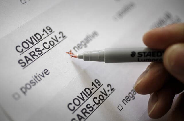 Coronavirus Diagnose. COVID-19, SARS-CoV-2, Symbolfoto. Berlin, 26.02.2020 Berlin Deutschland