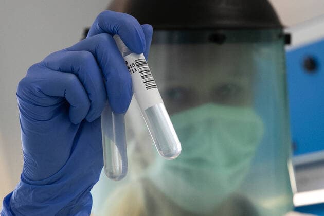 Symbolfoto, Labor, Coronavirus, Corona Virus, Schutzkleidung, Warnschild, Biogefährdung