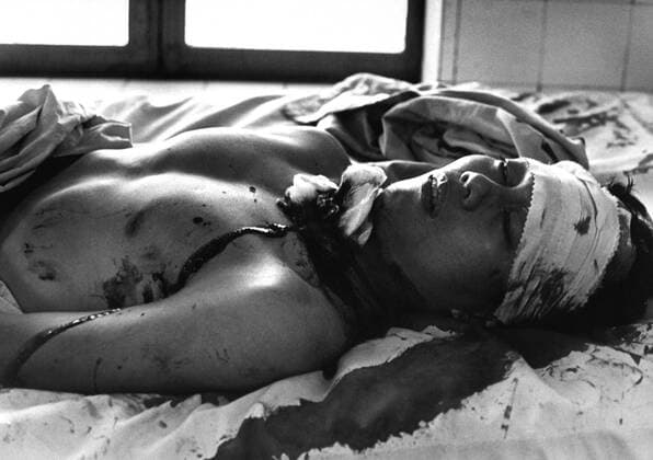 IMAGO History, Vietnamkrieg: 1955-1975 Vietnam War. One of 48 persons wounded by a Viet Cong explosion which killed 14 persons in Saigon awaits treatment in the Cong Hoa Hospital. Blast was set off on a busy street corner and the victims included women and children. Feb. 1966. Courtesy Everett Collection PUBLICATIONXNOTxINxCANxCHNxFRAxITAxJPNxNORxPOLxRUSxESPxUKxUSA Copyright: xCourtesyxEverettxCollectionx HISL033 EC584