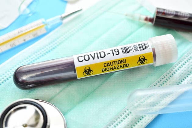 BlutentnahmerÃ¶hrchen mit Aufschrift Covid-19, Symbolfoto Coronavirus
