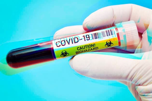 Hand mit Latexhandschuh hÃ¤lt BlutentnahmerÃ¶hrchen mit Aufschrift Covid-19, Symbolfoto Coronavirus