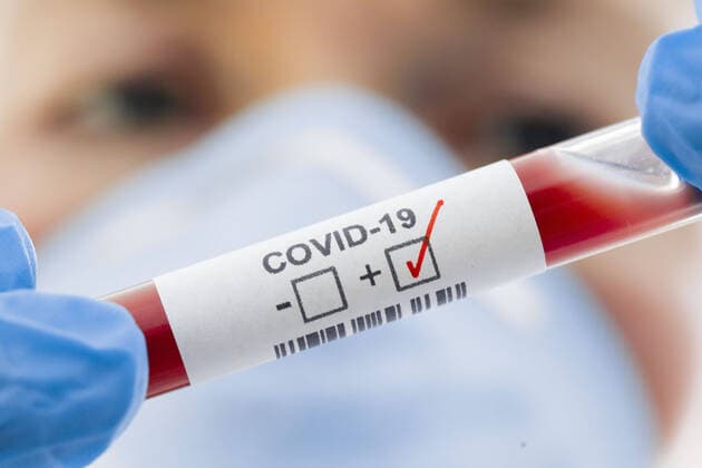 Gestellte Aufnahme. Symbolfoto: Coronavirus Diagnose. COVID-19, SARS-CoV-2. Berlin, 05.03.2020 Berlin Deutschland