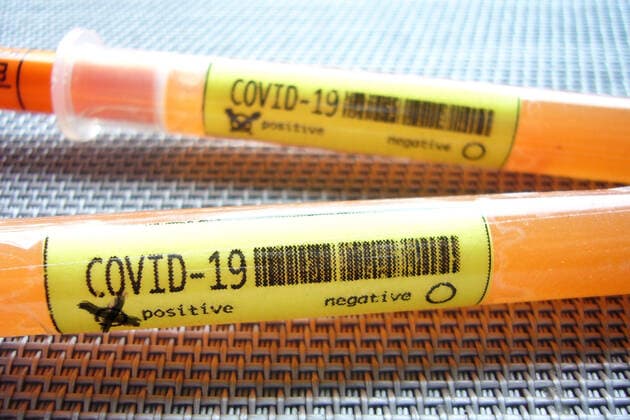 SYMBOLFOTO: Inzwischen sind in fast allen Bundeslaendern Infektionsfaelle mit dem neuen Coronavirus Covid-19 (SARS-CoV-2) bestaettigt worden. Test,Ampullen,Bluttest,Corona Test.