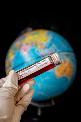 Verbreitung von Coronavirus SARS CoV 2 in die Welt