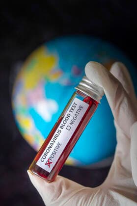 Verbreitung von Coronavirus SARS CoV 2 in die Welt