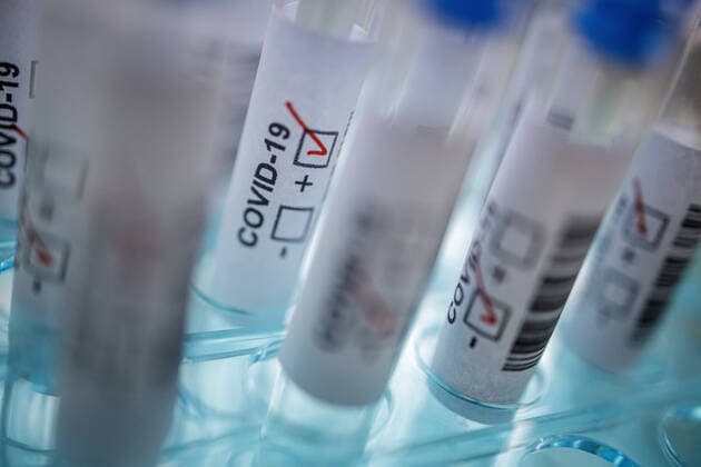Gestellte Aufnahme. Symbolfoto: Coronavirus Diagnose. COVID-19, SARS-CoV-2. Berlin 10.03.2020 Berlin Deutschland