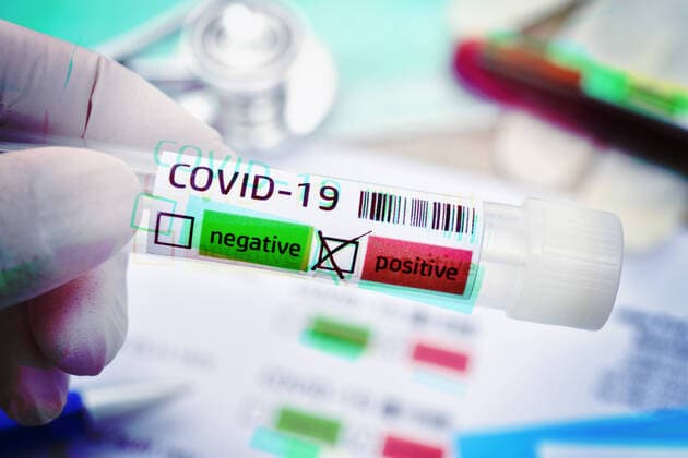 Abstrich-RÃ¶hrchen mit positivem Covid-19-Befund, Symbolfoto Coronavirus