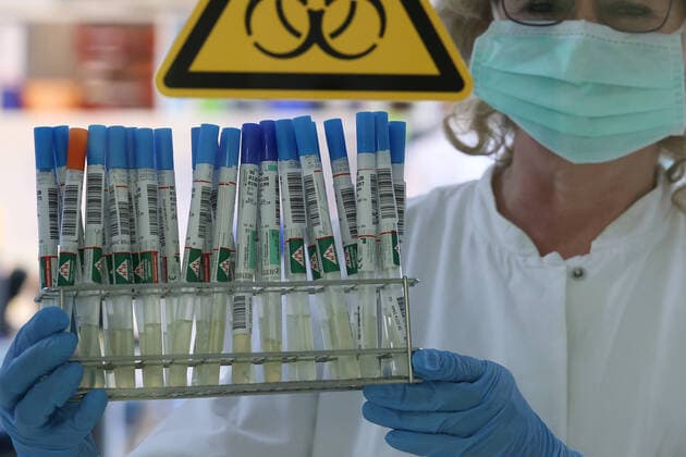 Symbolfoto, Coronavirus, Labor, Test, Abstrich, Virus,