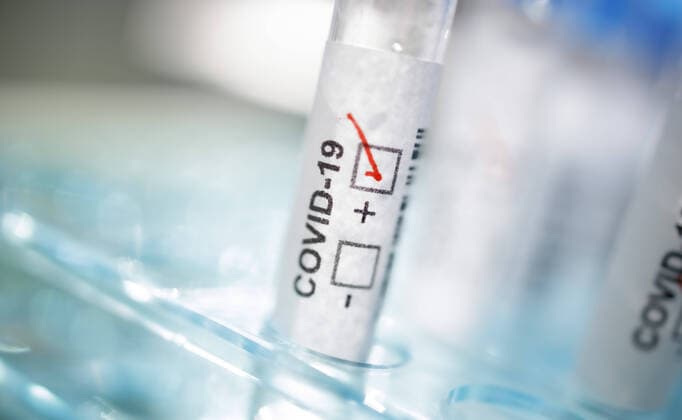 Gestellte Aufnahme. Symbolfoto: Coronavirus Diagnose. COVID-19, SARS-CoV-2. Berlin 17.03.2020 Berlin Deutschland