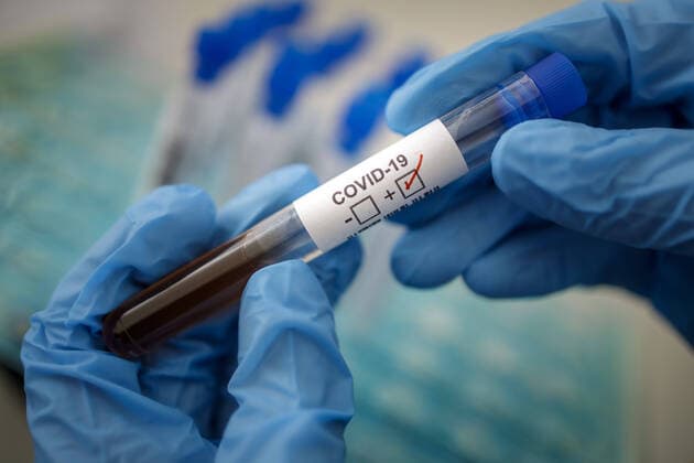 Gestellte Aufnahme. Symbolfoto: Coronavirus Diagnose. COVID-19, SARS-CoV-2. Berlin 17.03.2020 Berlin Deutschland