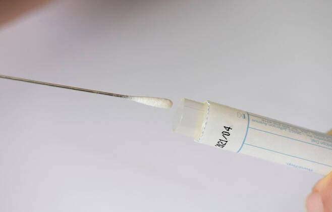 22.03.2020, Abstrichtest für einen Zungenabstrich mit Teststäbchen. 22.03.2020, Abstrichtest 22.03.2020, Abstrichtest