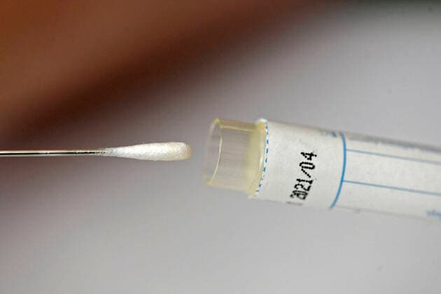 22.03.2020, Abstrichtest für einen Zungenabstrich mit Teststäbchen. 22.03.2020, Abstrichtest 22.03.2020, Abstrichtest