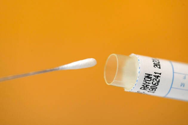 22.03.2020, Abstrichtest für einen Zungenabstrich mit Teststäbchen. 22.03.2020, Abstrichtest 22.03.2020, Abstrichtest
