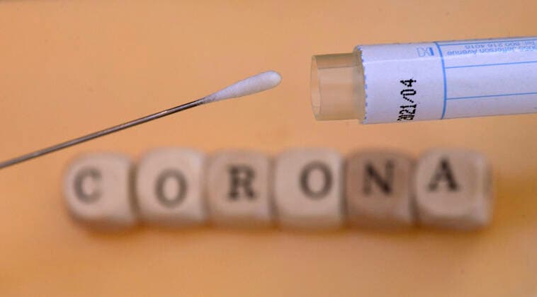 22.03.2020, Abstrichtest für einen Zungenabstrich mit Teststäbchen. Corona-Viren. 22.03.2020, Abstrichtest 22.03.2020, Abstrichtest