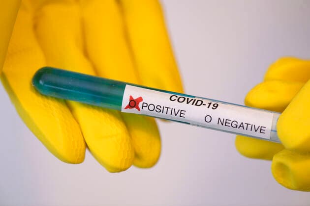 22.03.2020, Symbolbild Corona-Test, Positives Testergebnis. 22.03.2020, Symbolbild Corona-Test 22.03.2020, Symbolbild Corona-Test