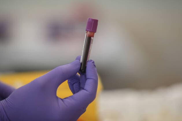 March 26, 2020: 26 March 2020 (Malaga) Despite the state alarm by the coronavirus are asking the people of Malaga to donate blood to hospitals for the sick because of their shortage of blood for transfusions. - ZUMAc161 20200326_zap_c161_031 Copyright: xLorenzoxCarnerox