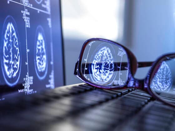 Brain scan results reflecting in protective glasses lying on laptop keyboard  ABRF00706