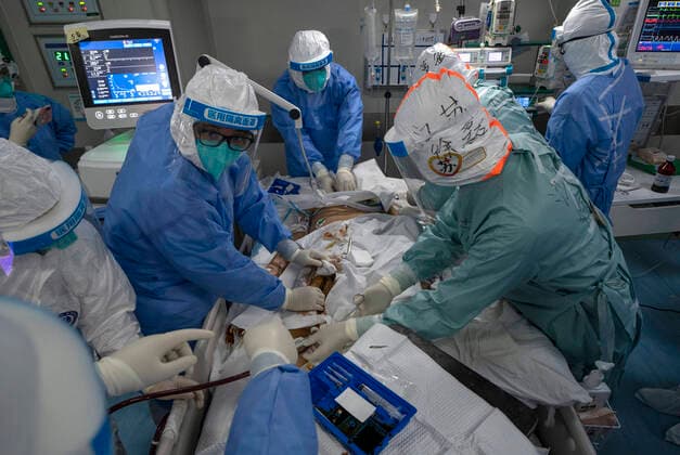Coronavirus in China, Eindrücke aus einem Krankenhaus in Wuhan (200406) -- WUHAN, April 6, 2020 -- Medical staff take off the ECMO machine used to support senior Hu s lungs at the Wuhan pulmonary hospital in Wuhan, capital of central China s Hubei Province, April 5, 2020. A patient surnamed Hu, a 40-year-old severe case of the COVID-19 who was diagnosed with the disease in early February, has the functions of his lungs recovered on Sunday at the Wuhan pulmonary hospital with days of extracorporeal membrane oxygenation (ECMO) support. ) CHINA-WUHAN-COVID-19-SEVERE CASE-LUNG FUNCTIONS-RECOVERY (CN) FeixMaohua 
