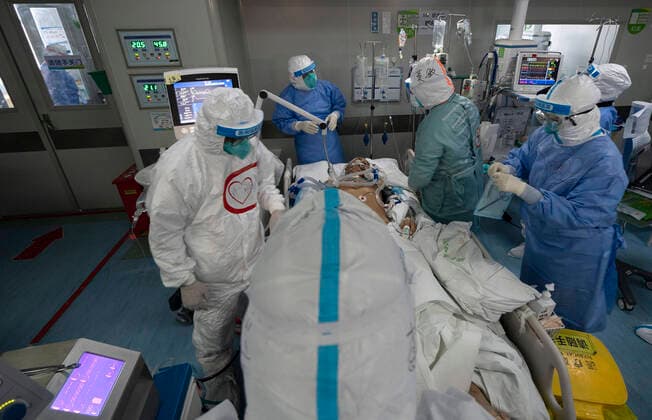 Coronavirus in China, Eindrücke aus einem Krankenhaus in Wuhan (200406) -- WUHAN, April 6, 2020 -- Medical staff prepare to take off the ECMO machine used to support senior Hu s lungs at the Wuhan pulmonary hospital in Wuhan, capital of central China s Hubei Province, April 5, 2020. A patient surnamed Hu, a 40-year-old severe case of the COVID-19 who was diagnosed with the disease in early February, has the functions of his lungs recovered on Sunday at the Wuhan pulmonary hospital with days of extracorporeal membrane oxygenation (ECMO) support. ) CHINA-WUHAN-COVID-19-SEVERE CASE-LUNG FUNCTIONS-RECOVERY (CN) FeixMaohua 