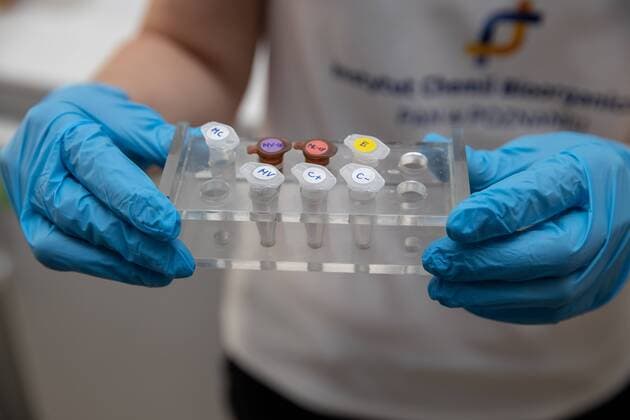Polish scietists have developed their own test for SARS-CoV-2 detection Polish scientists of the Institute of Bioorganic Chemistry Polish Academy of the Sciences have developed their own test for SARS-CoV-2 detection on April 10, 2020 in Poznan, Poland. EN_01424292_0002 