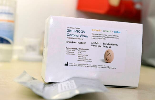 22.04.2020, COVID-19 Antikörper-Test-Kit, Corona Virus Schnelltest ist ein schneller chromatographischer Immunoassay zum qualitativen Nachweis von IgG- und IgM-Antikörpern gegen SARS-CoV-2 im menschlichen Vollblut, Serum oder Plasma als Hilfe bei der Diagnose von primären und sekundären SARS-CoV-2-Infektionen. 22.04.2020, Corona-Virus Antikörper-Test 22.04.2020, Corona-Virus Antikörper-Test