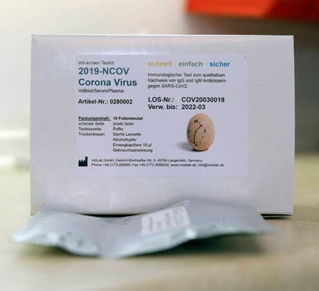 22.04.2020, COVID-19 Antikörper-Test-Kit, Corona Virus Schnelltest ist ein schneller chromatographischer Immunoassay zum qualitativen Nachweis von IgG- und IgM-Antikörpern gegen SARS-CoV-2 im menschlichen Vollblut, Serum oder Plasma als Hilfe bei der Diagnose von primären und sekundären SARS-CoV-2-Infektionen. 22.04.2020, Corona-Virus Antikörper-Test 22.04.2020, Corona-Virus Antikörper-Test