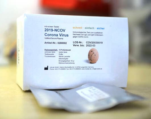 22.04.2020, COVID-19 Antikörper-Test-Kit, Corona Virus Schnelltest ist ein schneller chromatographischer Immunoassay zum qualitativen Nachweis von IgG- und IgM-Antikörpern gegen SARS-CoV-2 im menschlichen Vollblut, Serum oder Plasma als Hilfe bei der Diagnose von primären und sekundären SARS-CoV-2-Infektionen. 22.04.2020, Corona-Virus Antikörper-Test 22.04.2020, Corona-Virus Antikörper-Test