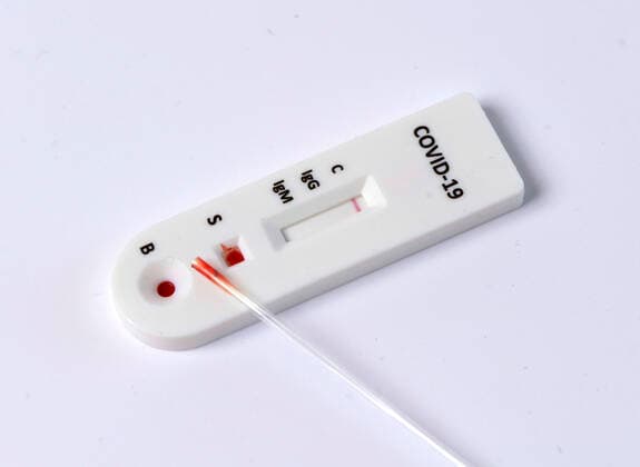 23.04.2020, EIn benutzter COVID-19 Antikörper-Testkit zum Eigentest im Privat-Einsatz am Küchentisch, mit der sterilen Einwegkapillare saugt man einen Bluttropfen von seinem Finger für den Teststreifen. Die Anzeige zeigt das Ergebnis: Negativ. Der Corona Virus Schnelltest ist ein schneller chromatographischer Immunoassay zum qualitativen Nachweis von IgG- und IgM-Antikörpern gegen SARS-CoV-2 im menschlichen Blut als Hilfe bei der Diagnose von SARS-CoV-2-Infektionen. Mit der Testkassette, Einwegkapillare (Pipette), Sterile Lanzette (Nadel) 23.04.2020, Corona-Virus Antikörper-Test im Privat-Einsatz 23.04.2020, Corona-Virus Antikörper-Test im Privat-Einsatz