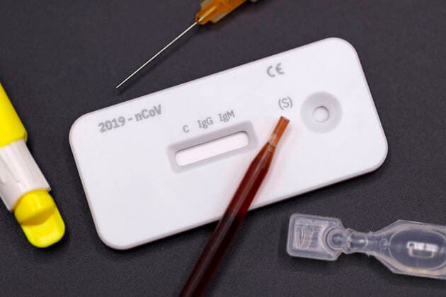 Corona-Test bzw. Cleartest für Corona der Firma servoprax für den qualitativen Nachweis von IgG- und IgM-Antikörpern gegen 2019-nCov in menschlichen Vollblutproben aus der Fingerbeere.
