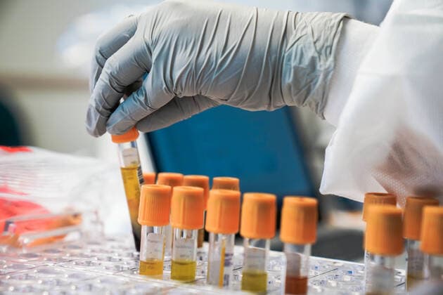 April 22, 2020, Apra, Guam, United States: U.S. Navy Hospitalman Karlie Doll, sorts blood sample from sailors assigned to the aircraft carrier USS Theodore Roosevelt as part of contact tracing for COVID-19, coronavirus outbreak aboard the ship April 22, 2020 in Apra, Guam. Apra United States - ZUMAp138 20200422_zaa_p138_039 Copyright: xKelseyxHockenberger U.S.xNavyx