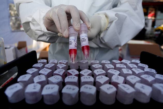 Bilder des Jahres 2020, News 05 Mai News Bilder des Tages May 13, 2020, Bandung, West Java, Indonesia: Health officers use self-protective clothing when they exhibit a test swab sample inside the tube during a coronavirus disease (COVID-19) in the Terminal. The test swab was executed randomly in several terminals to map more broadly the Covid-19 spread. Bandung Indonesia - ZUMAf147 20200513_zip_f147_008 Copyright: xAgvixFirdausx