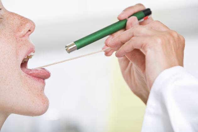 rachenuntersuchung,hals-nasen-ohren-heilkunde,hals-nasen-ohren-arzt *** throat examination,otolaryngologist,otolaryngologist ln0-4,model released, Symbolfoto