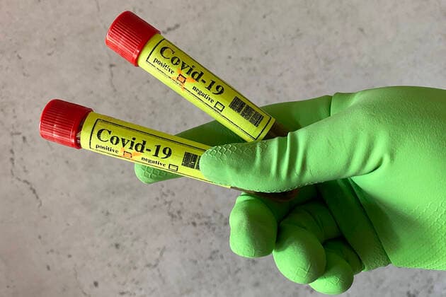 SYMBOLFOTO,THEMENBILD CORONAVIRUS PANDEMIE. Test,Ampullen,Bluttest,Corona Test.Ampulle,Roehrchen in Haenden-geschuetzt mit Schutzhandschuhen.