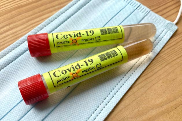 SYMBOLFOTO,THEMENBILD CORONAVIRUS PANDEMIE. Test,Ampullen,Bluttest,Corona Test.Ampulle,Roehrchen liegen auf einem Mund-Nasenschutz,Mundschutz,Maske,