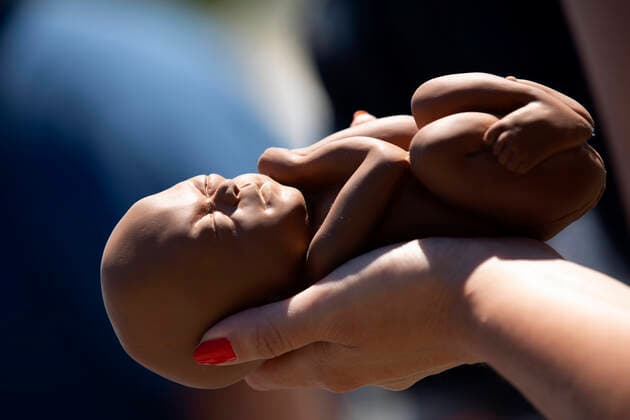 June 29, 2020, Washington, District of Columbia, USA: A Pro-Life activist holds a 22 week fetal model during a rally outside the United States Supreme Court in Washington D.C., U.S., on Monday, June 29, 2020. The Court delivered a 5-4 ruling blocking a restrictive abortion law in Louisiana Monday morning. Credit: CNP Washington USA - ZUMAs152 20200629_zaa_s152_017 Copyright: xStefanixReynoldsx