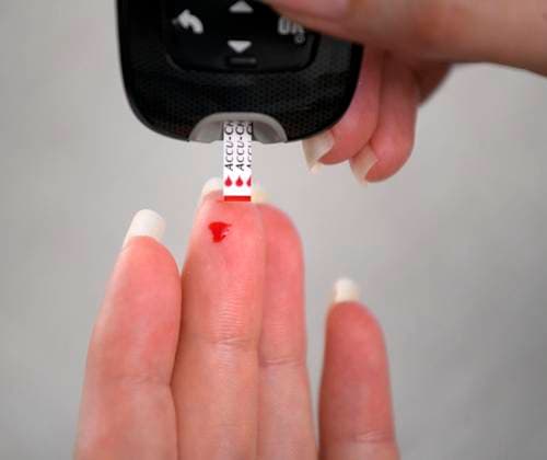 30.06.2020, Ernährung mit Diabetes: Patientin misst mit einem Teststreifen vom Accu-Chek, dem Test aus der Apotheke, ihren Blutzuckerspiegel. 30.06.2020, Blutzucker-Messung 30.06.2020, Blutzucker-Messung *** 30 06 2020, diabetes patient measures her blood sugar level with a test strip from Accu Chek, the test from the pharmacy, her blood sugar level 30 06 2020, blood sugar measurement 30 06 2020, blood sugar measurement