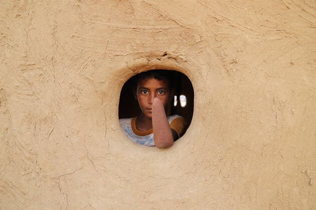 (200713) -- HAJJAH, July 13, 2020 (Xinhua) -- Mohammed Kadish s grandson Ahmed, who had his left hand blown off in a landmine explosion, is seen though a window of a hut in Abs District, Hajjah province, Yemen, July 4, 2020. TO GO WITH: Feature: Landmines in Yemen pose big dangers to civilians lives (photo by Mohammed ALwafi Xinhua) YEMEN-HAJJAH-LANDMINES-VICTIMS 