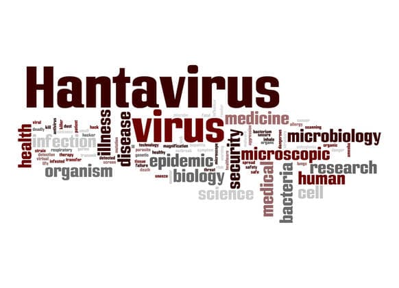 Hantavirus virus word cloud Hantavirus virus word cloud  Copyright: xtang90246x 13642626