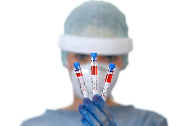 Positives Testergebnis, medizinisches Personal beim RT-PCR, Real-time Reverse Transkriptase Polymerase-Kettenreaktion, Corona-Test, Corona-Krise, Baden-Württemberg, Deutschland, Europa Copyright: imageBROKER/MichaelxWeber ibximw05909127.jpg