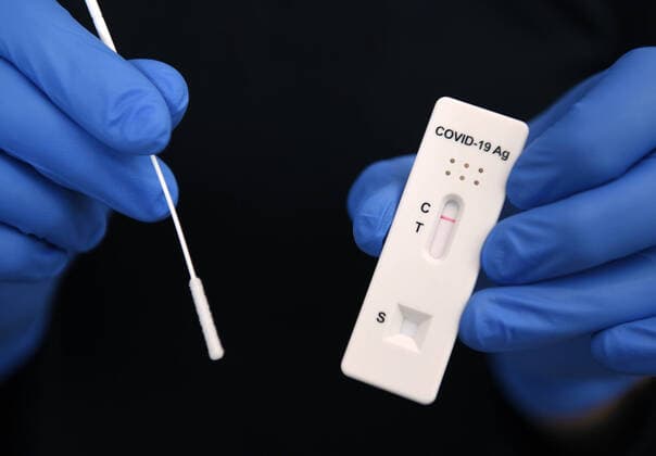 Tuebingen 03.12.2020 Symbolbild: Negativer SARS-CoV-2 Rapid Antigen Schnelltest und Tupfer