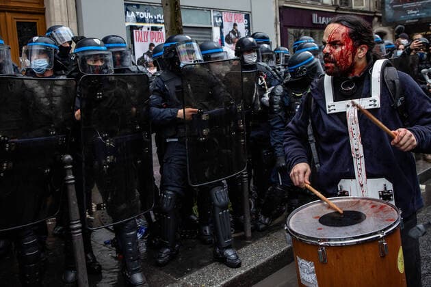 Bilder des Jahres 2020, News 12 Dezember News Themen der Woche KW50 News Bilder des Tages Paris, France le 12 decembre 2020 - Un manifestant blesse par une charge de la police joue du tambour pendant la manifestation contre le projet de loi sur la securite globale . Troisieme week end de manifestations en France contre un projet de loi sur la securite actuellement en cours d examen au Parlement francais, qui limiterait la publication de photos montrant les visages des policiers. Protestor injured by police charge drumming during a demonstration in Paris on december 12, 2020, against the global security draft law. It is the third weekend of demonstrations in France during protests against a security bill currently going through French parliament, that would restrict publication of pictures showing the faces of police.  Copyright: xAurelienxMorissardx
