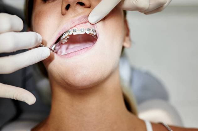 From above crop unrecognizable female dentist in gloves using mirror to check teeth of woman with braces during work in contemporary clinic, Model released, Property released Copyright: xJuanxGarciax MR